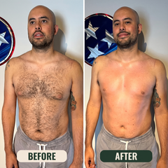 Before and after